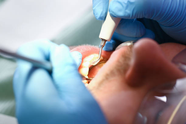 Best Broken Tooth Emergency  in Slippery Rock, PA