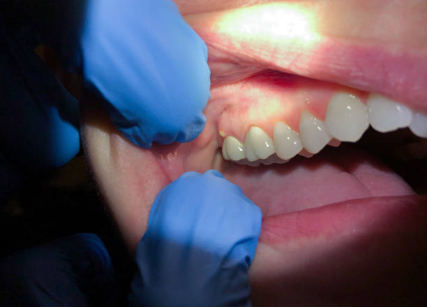 Best Dentist Open Late Near Me  in Slippery Rock, PA